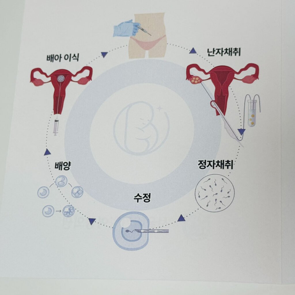체외수정 시험관 과정