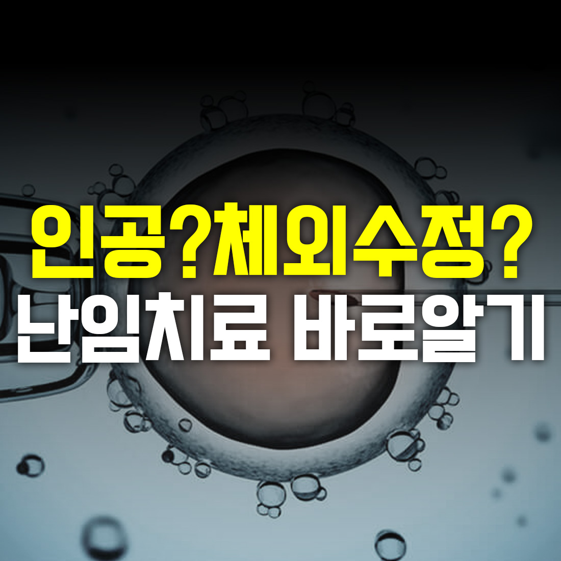 인공수정 체외수정 난임치료 바로알기