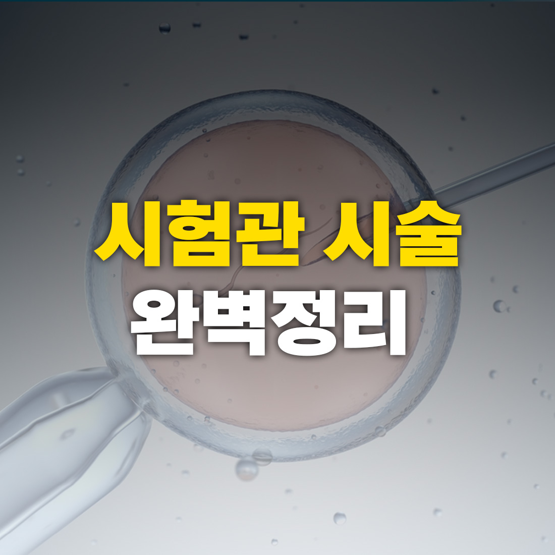 시험관 아기 시술 완벽정리